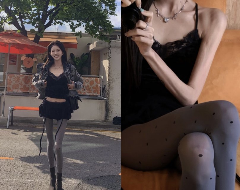 최준희, 살가죽만 남은 ‘극세사’ 팔 자랑