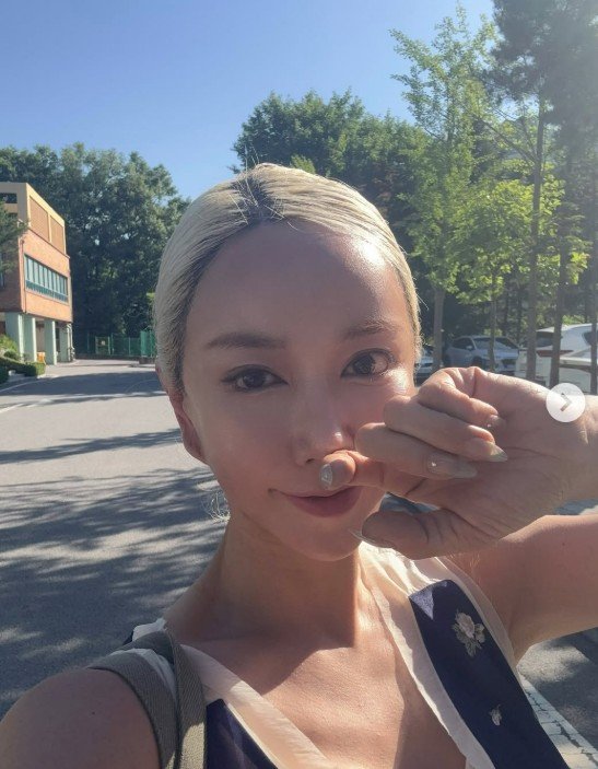 44세 슈, 레이저 시술 후 매끈 피부 자랑…금발 변신