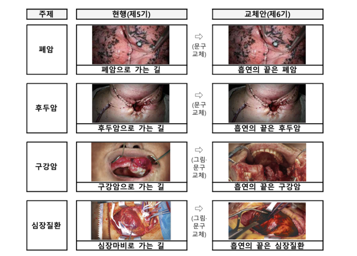 “흡연의 끝은 폐암”…담뱃갑 문구 더 강하고 직관적으로 바뀐다