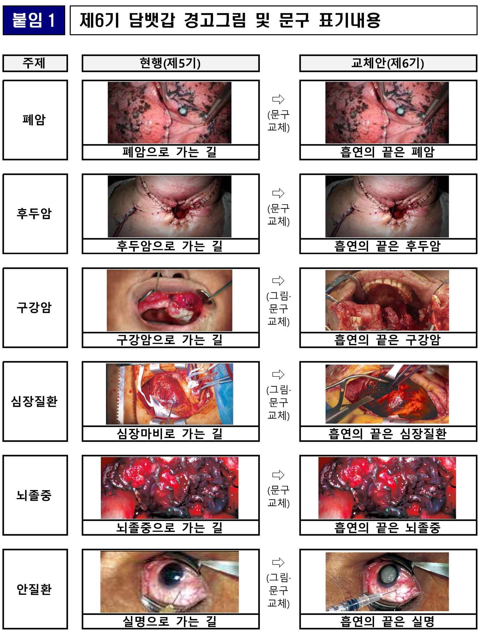 12월 23일부터 새로 적용되는 담뱃갑 경고 그림과 문구들. 훨씬 더 직관적이고 강한 표현의 문구로 교체된다. 보건복지부 제공