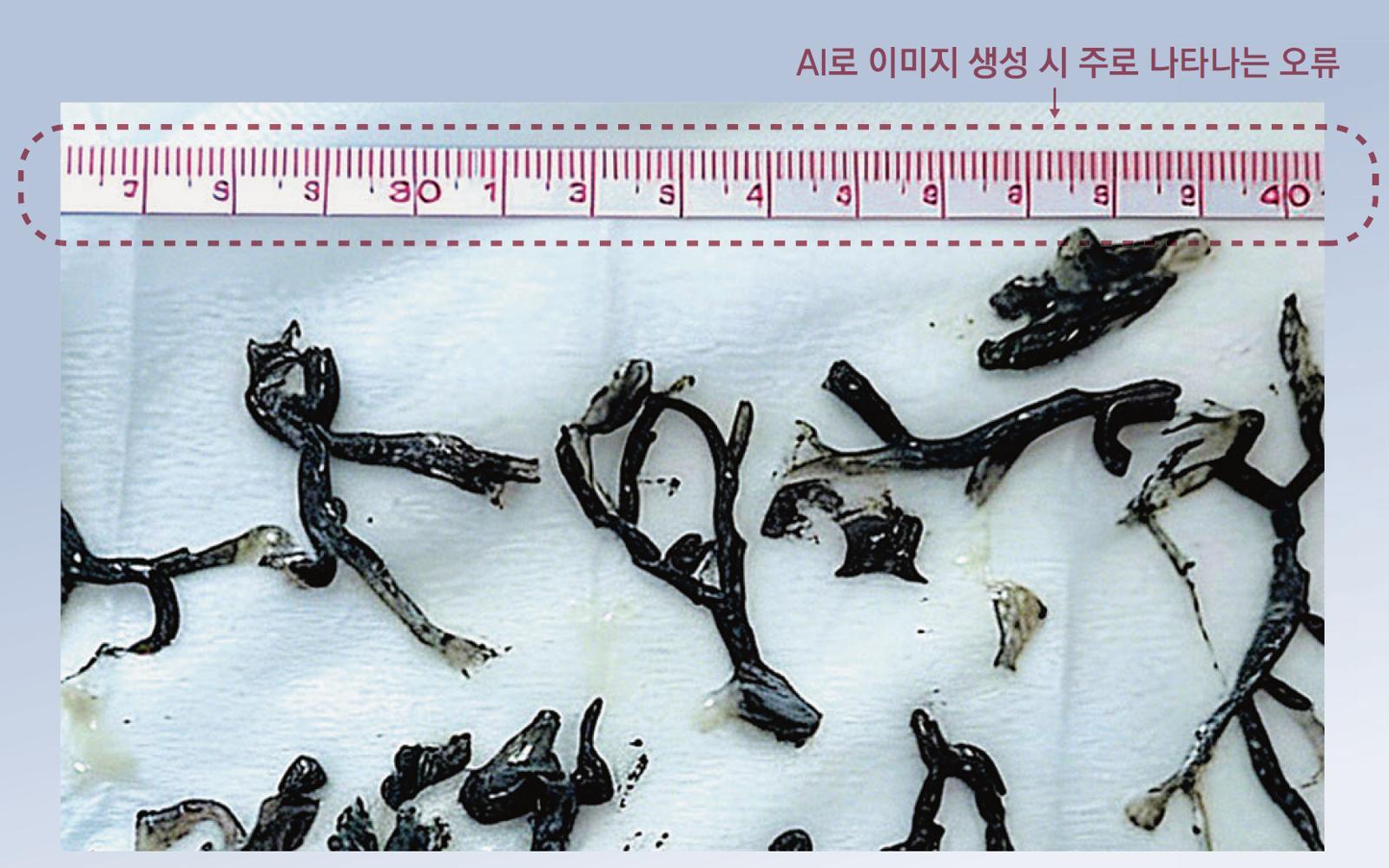 올해 4월 국제 의학 학술지 ‘뉴잉글랜드저널오브메디신(NEJM)’에 실렸던 중국 연구진의 논문 속 사진. 산불 연기를 흡입한 사람의 기관지에서 발견된 검은색 침전물을 찍은 것으로, 줄자의 눈금 숫자가 달라 해당 사진이 조작된 것임을 확인할 수 있다. NEJM은 해당 논문을 10일 만에 철회시켰다. NEJM 제공