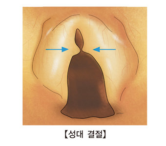 서울아산병원 제공
