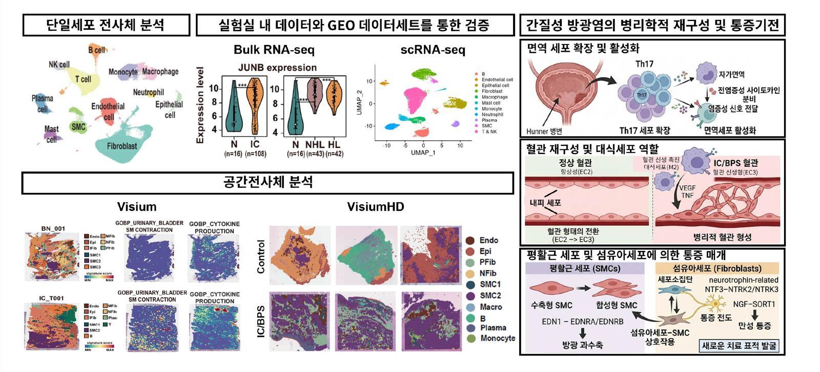 원인 몰랐던 간질성 방광염…“통증 이유 찾았다”
