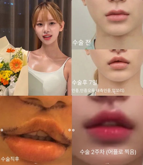 ‘무도’ 맹승지 맞아?…인중축소술 후 확 바뀐 얼굴