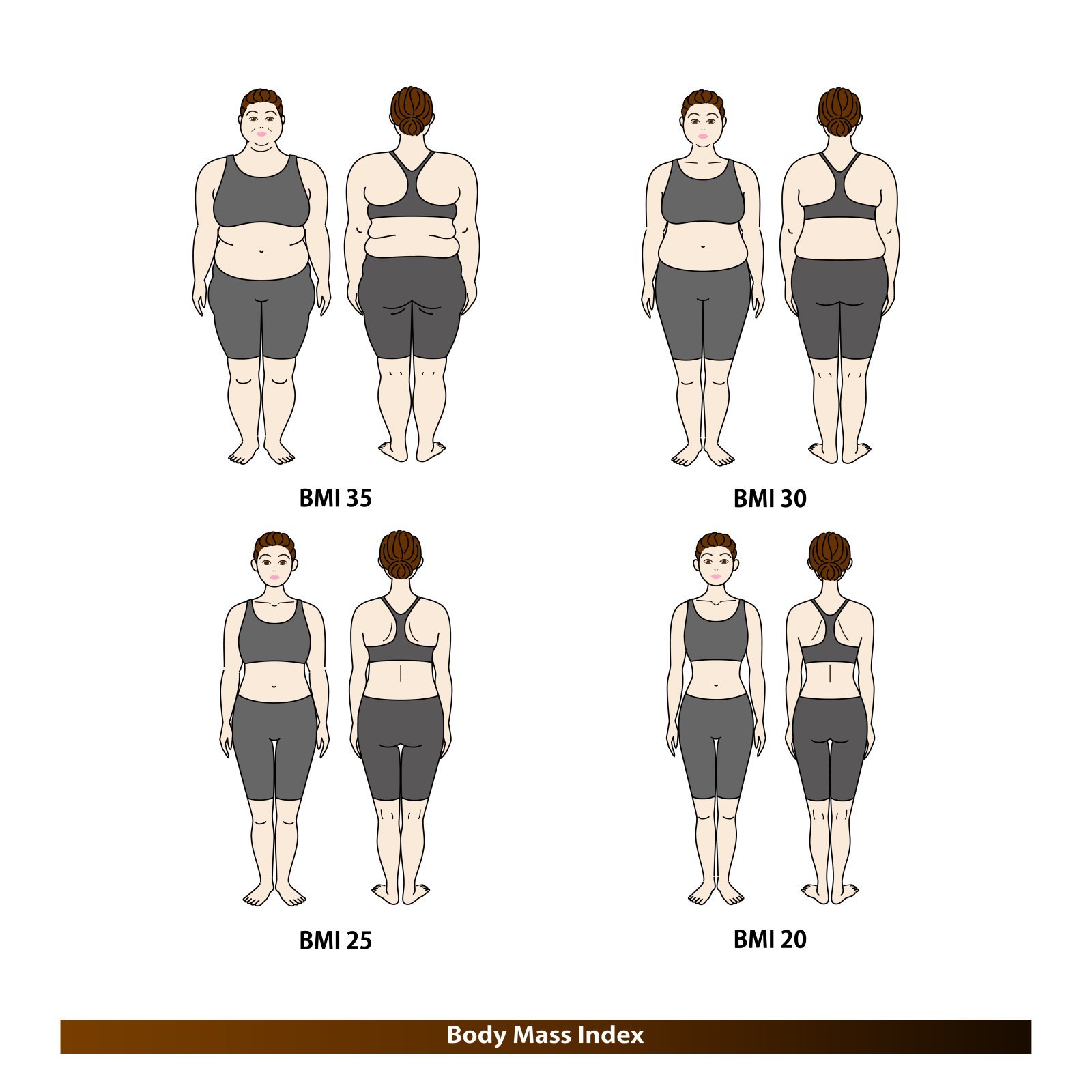 Normal BMI Doesn't Guarantee Health: 32% of Koreans at Risk of Metabolic Disease