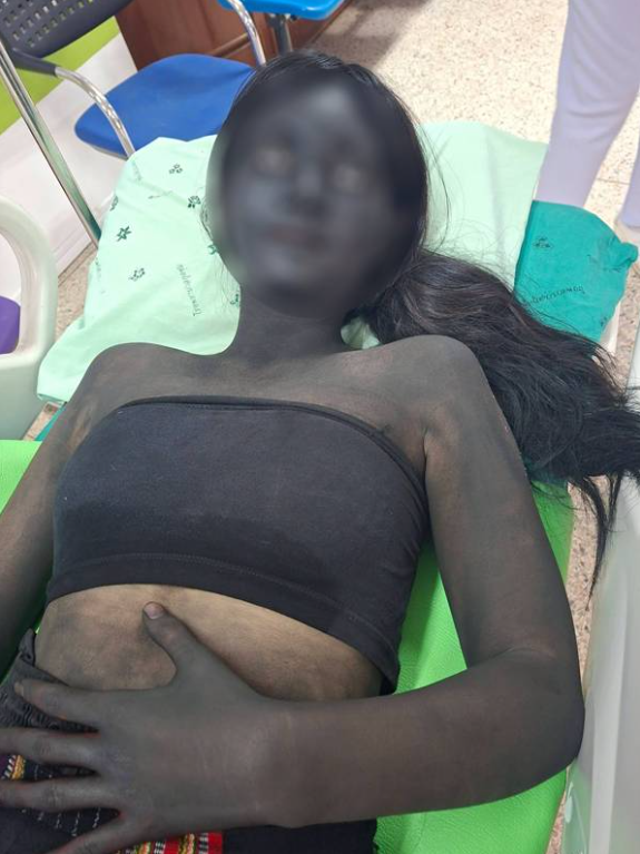 응급실에 실려온 ‘귀신분장’ 환자에 의료진 ‘깜놀’…“시신 싣고 온줄”
