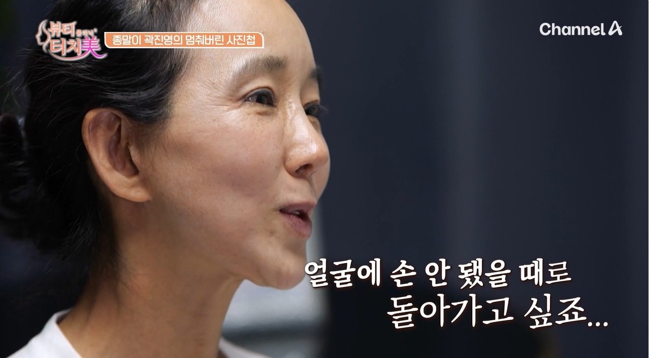 Actress Kwak Jin-young regrets plastic surgery due to side effects
