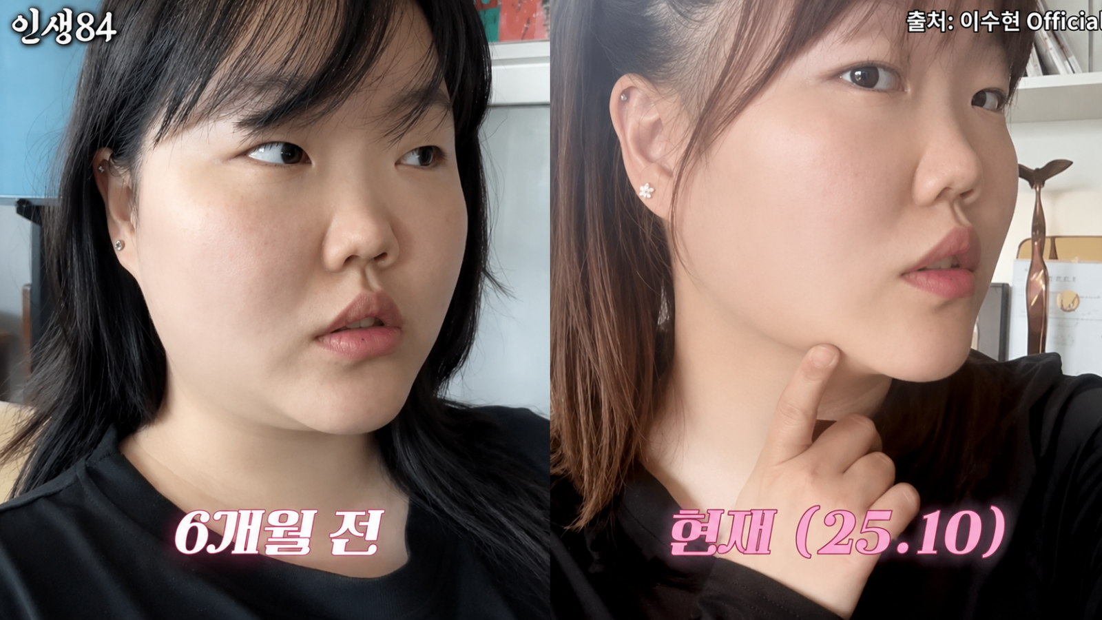 AKMU 이수현, 39kg 감량 뒤 고백 “술 취하니 토할 때까지 먹어…몸 망가질 것 같았다”