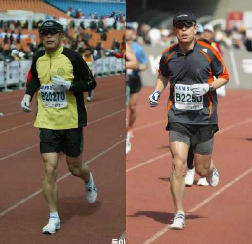 목 골절 수술 뒤에도 달린 72세 교수…“누우면 죽고, 달리면 산다” [양종구의 100세 시대 건강법]