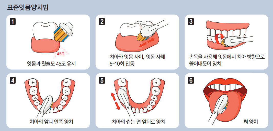 찬 음료만 마시면 치아가 ‘찌릿’… 충치보다 ‘양치 습관’ 탓일 수도