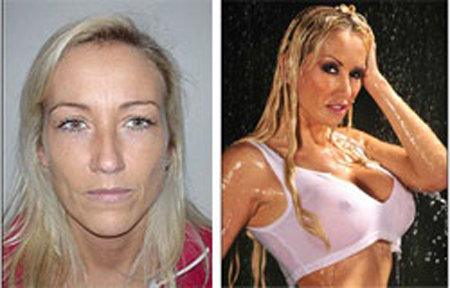 남편이 시술한 8번의 성형수술로 평범한 얼굴(왼쪽)에서 완벽 몸매로 바뀐 카니 포우소그.