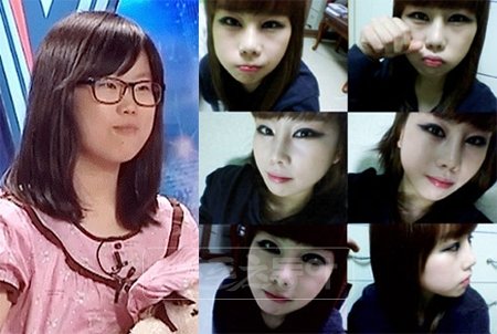 ‘슈퍼스타K2’ 출신 가수 우은미 (왼쪽 성형전-오른쪽 성형후).