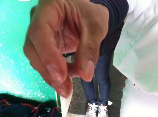 준PO 1차전 윤석민 손가락 물집. 스포츠동아DB