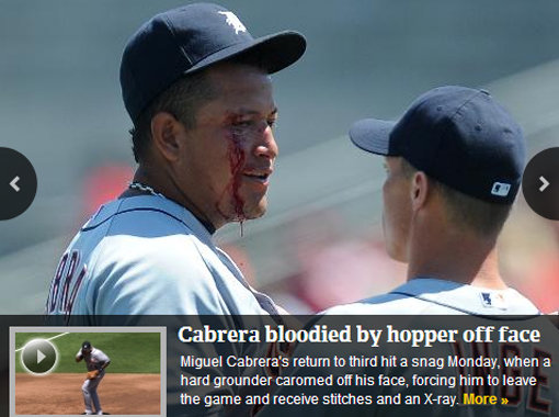 미겔 카브레라(디트로이트)가 20일 필라델피아 필리스와의 시범경기에서 타구에 얼굴을 맞고 부상 당한 모습. 메이저리그 공식 홈페이지 캡처