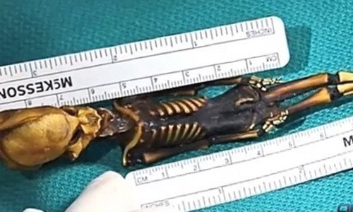 15cm 외계인 DNA 검사. 사진출처 ｜ 유투브 영상 캡처