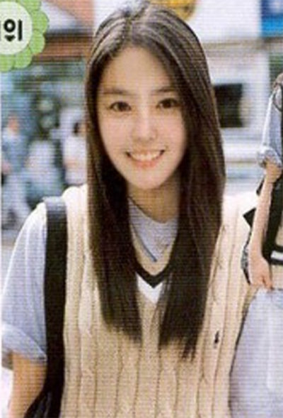 ‘짝 여자 1호 바나나걸 김상미 성형’