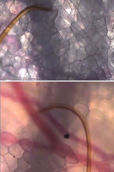 모기가 무는 순간