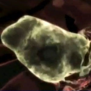 뇌 먹는 아메바