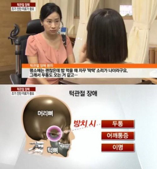 ‘턱관절 장애 급증’