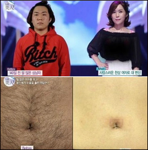 렛미인 김미영씨 파격 변신