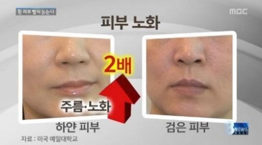 하얀 얼굴 빨리 노화