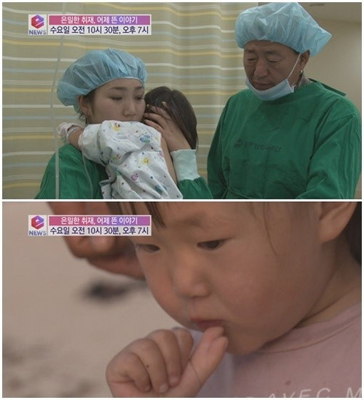 ‘유퉁 딸 유미 다지증’