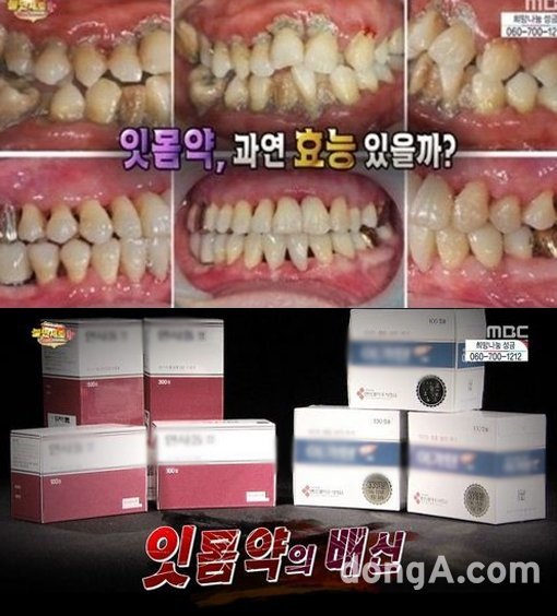 ‘불만제로 UP 잇몸약’