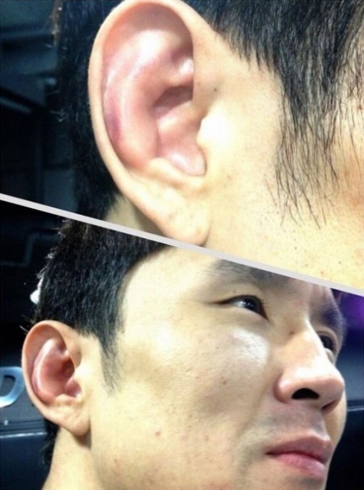 윤형빈 귀 모양. 사진=윤형빈 트위터.