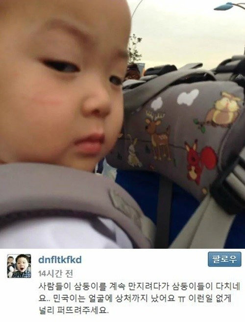 민국이 얼굴상처 사진출처 |'dnfltkfkd' 님의 인스타그램