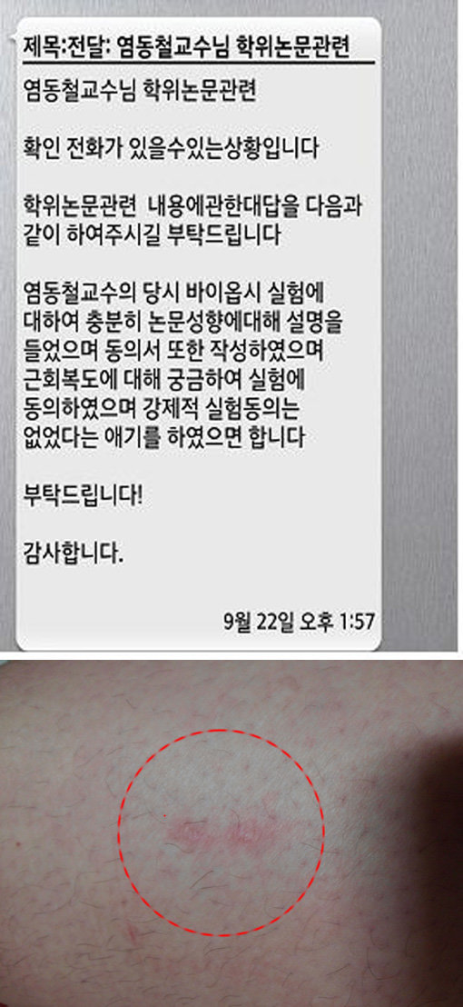 9월 중순 한체대의 생체실험 문제가 알려진 이후 실험대상이었던 선수들은 문자메시지를 받았다. “강제적 실험동의가 없었다고 말해달라”는 내용이었다. 이 메시지를 보낸 인물은 한체대 염동철 교수의 부탁을 받았던 것으로 알려졌다.(위) 2009년 허벅지 근육을 적출당한 역도선수들의 허벅지에는 지금도 2개의 흉터가 남아있다.(아래). 스포츠동아DB