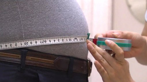 '비만으로 생기는 비용 2조 달러' 사진출처 | SBS 제공