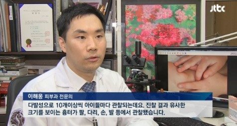 ‘어린이집 바늘 학대’. 사진출처｜방송캡처