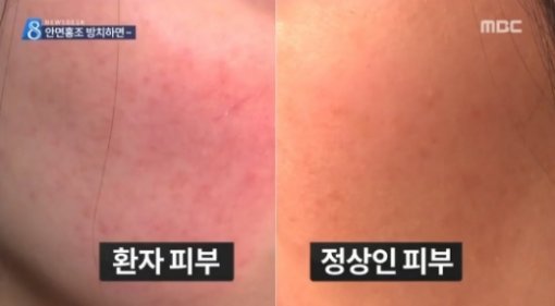 출처= MBC 영상 캡처