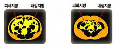 광동제약 가르시니아 복용 전, 후