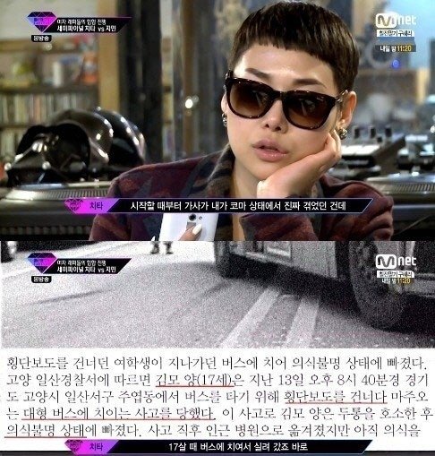 언프리티랩스타 치타 인공뇌사