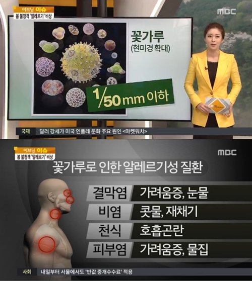 사진= MBC 화면캡처