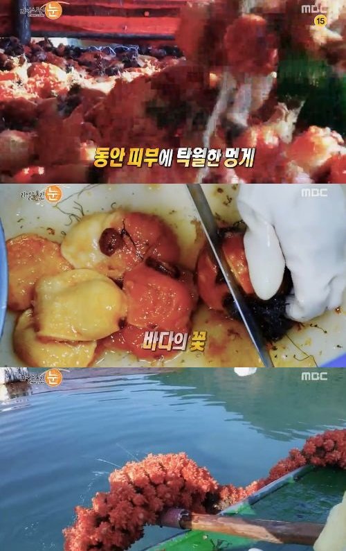 출처= MBC ‘리얼스토리 눈’ 방송 캡처