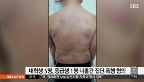 사진= SBS 뉴스 캡처, ‘동급생 폭행 대학생’