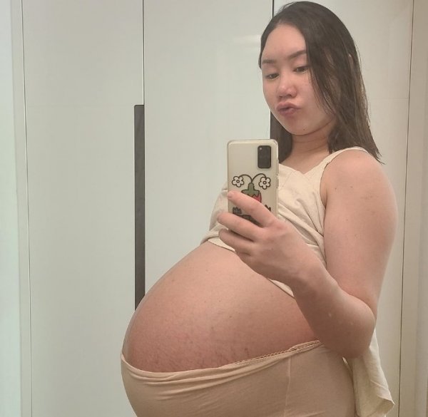 개그우먼 황신영. 사진출처｜SNS