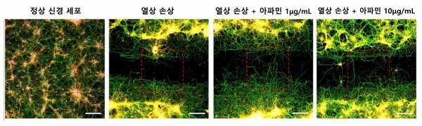 고배율 현미경 관찰 상 손상을 가한 신경세포와 비교해 아파민을 처리한 신경세포에서는 아파민 농도가 높을수록 축삭돌기의 재생량과 길이가 증가했다. 사진제공|자생한방병원 척추관절연구소
