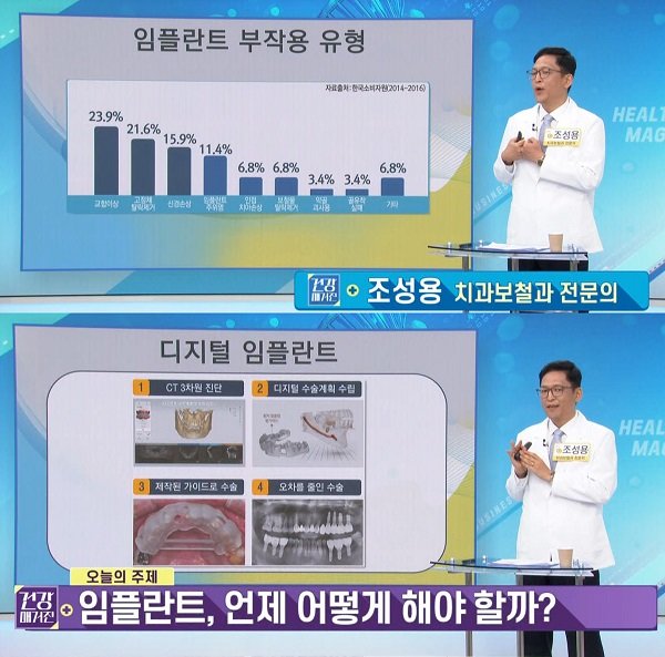 아이디치과 조성용 원장(보철과 전문의)이 지난 5일 한국경제TV 건강매거진에 출연해 임플란트와 관련한 다양한 정보를 전달했다.