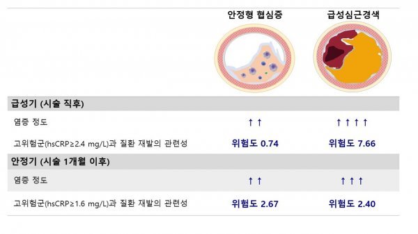 관상동맥질환에서의 염증 수치 변화 및 임상적 영향