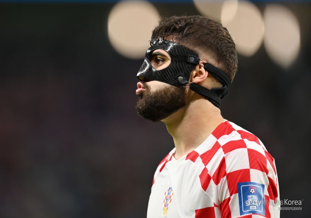 지난 카타르월드컵 때 안면 보호대를 착용한 그바르디올. 사진=게티이미지코리아.