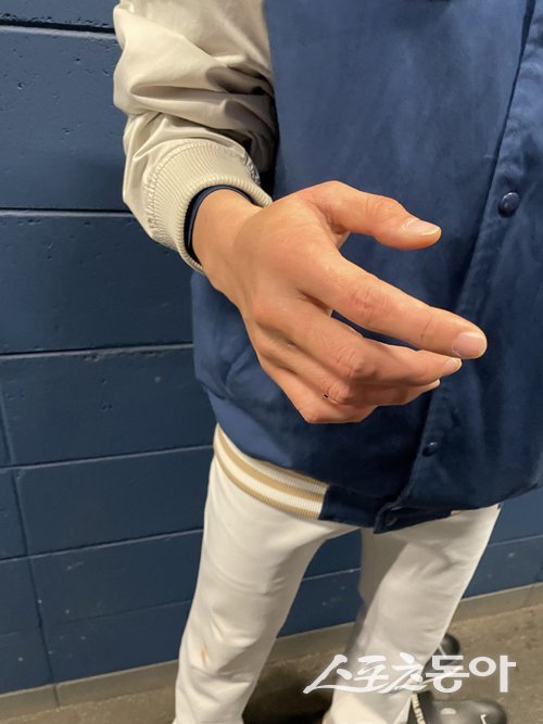 NC 다이노스 이재학이 25일 창원NC파크에서 열린 SSG 랜더스와 준PO 3차전이 끝난 뒤 인터뷰 도중 타구에 맞은 손을 보여주고 있다. 창원 | 강산 기자 posterboy@donga.com