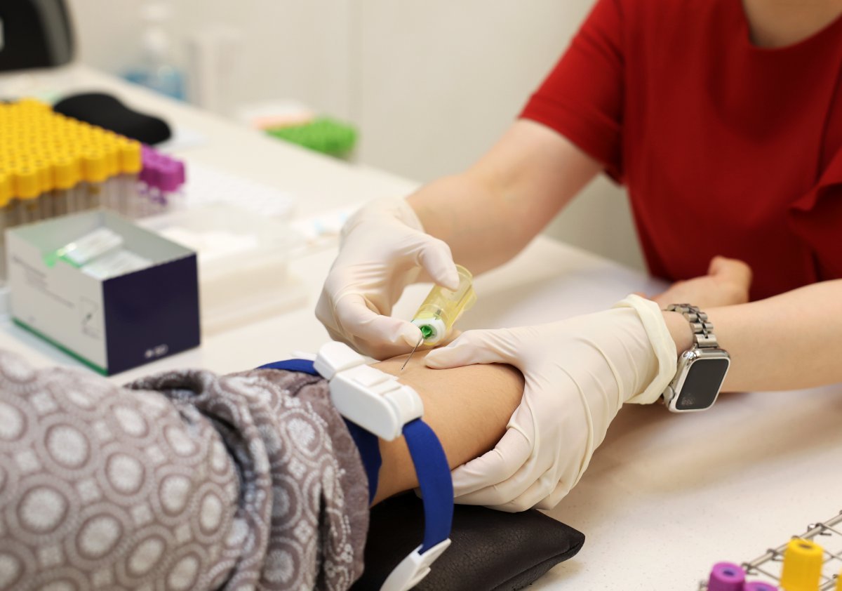 고려대안암병원의 암세포 탐색검사 사진제공|고려대안암병원