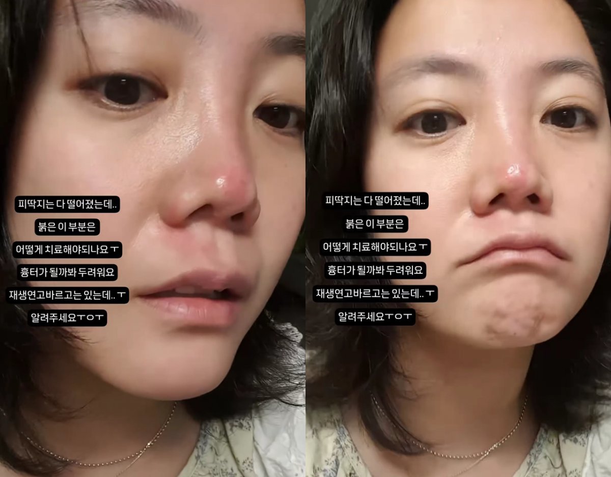 사진출처=고은아SNS