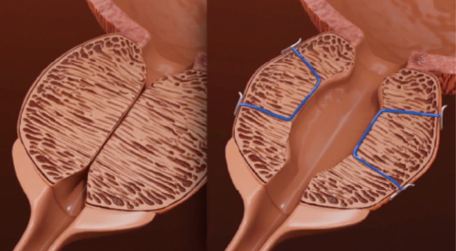 사진제공ㅣ스탠탑비뇨의학과의원