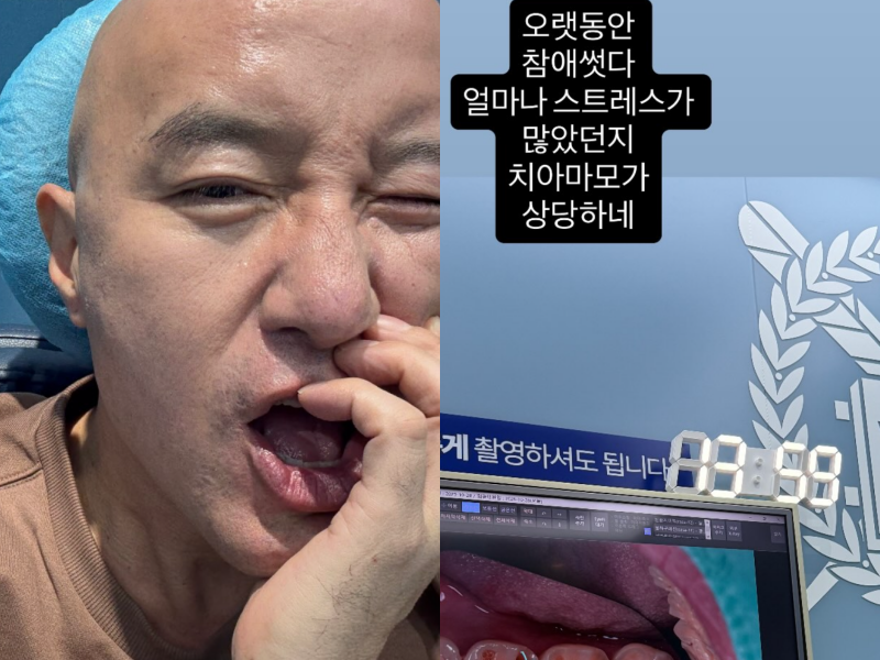 홍석천 소셜 캡처