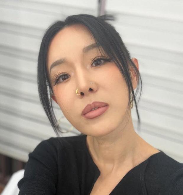 이지혜 인중 축소 후 완전히 달라진 얼굴 “요즘 사진 안 찍어”