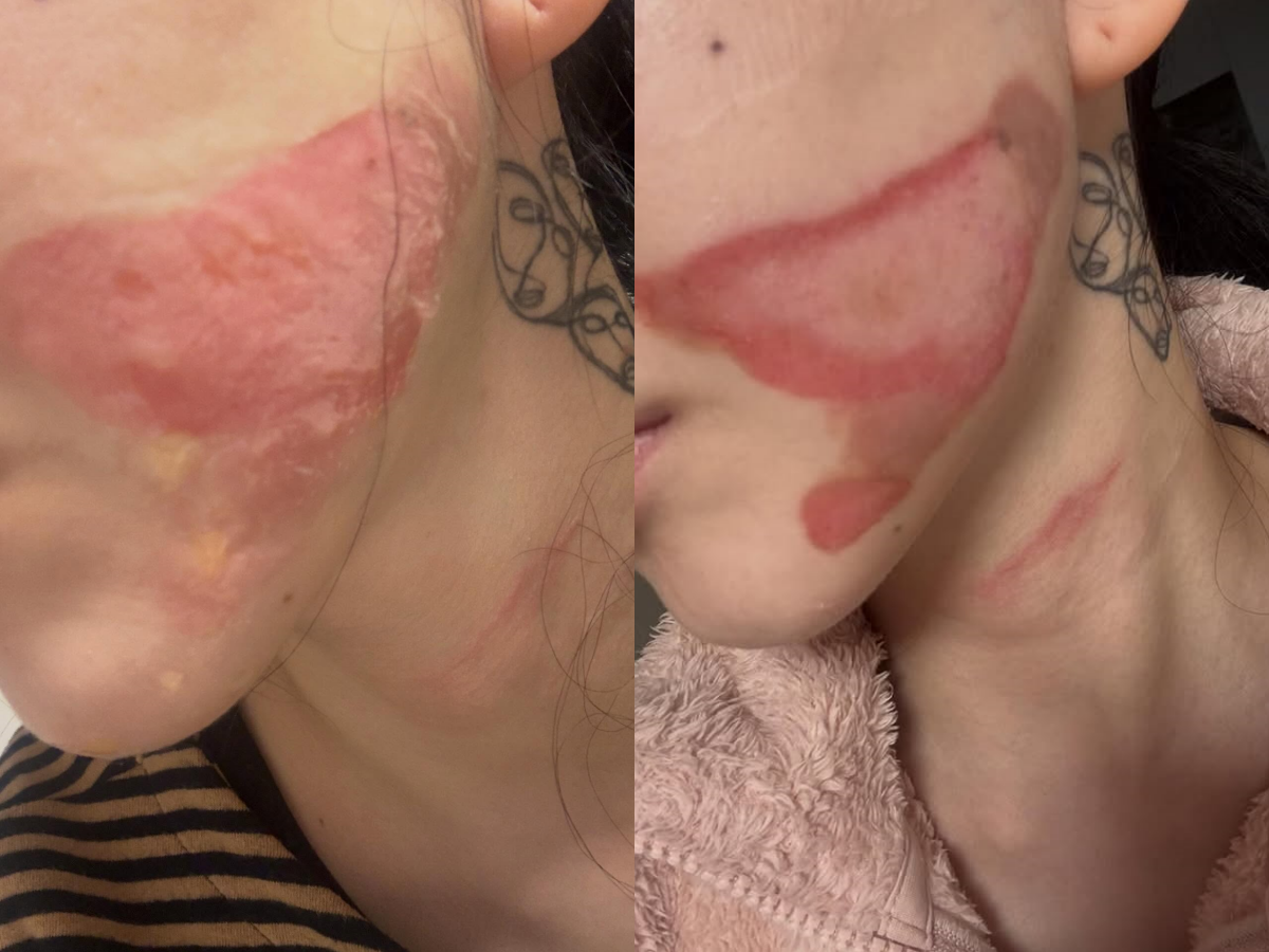 권민아 SNS 캡처